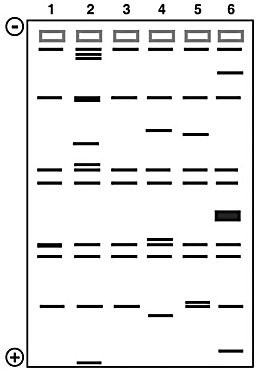 The figure illustrates the results of gel electrophoresis showing the separation of restriction fragments of D N A of different organisms labeled 1 through 6.